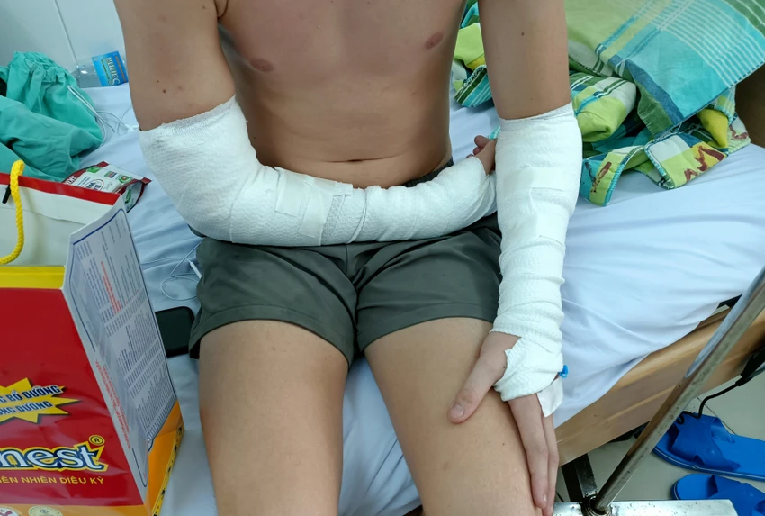 Anh Staker Zachary Paul đang điều trị tại bệnh viện. Ảnh: NĐ Nha Trang khởi động đội bắt chó thả rông