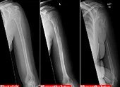 Người phụ nữ mắc bệnh cực hiếm, thế giới chỉ có 64 ca