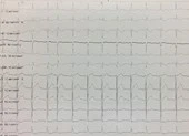 Chuyên gia Pháp 'bó tay', bác sĩ Việt trổ tài