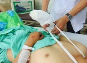 Thêm trường hợp nát bàn tay do pháo tự chế