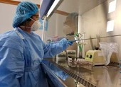 Thừa Thiên- Huế mua 10.000 test xét nghiệm nhanh