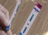 Vụ gian lận xét nghiệm HIV: Cục Phòng chống HIV/AIDS lên tiếng