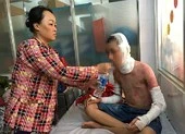 Đau đớn học sinh bỏng cồn trong phòng thí nghiệm