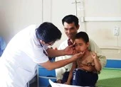 Sau trận ho, sốt, bé 5 tuổi mọc lông đầy người