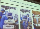 Ghép gan cứu sống bệnh nhân đã tiên lượng 90% tử vong