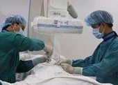 Bơm… xi măng để điều trị bệnh xẹp đốt sống