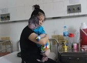 Mẹ mắc thủy đậu có được cho con bú?