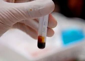 Xét nghiệm DNA ở đâu, chi phí bao nhiêu?