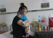 Mẹ mắc thủy đậu có được cho con bú?