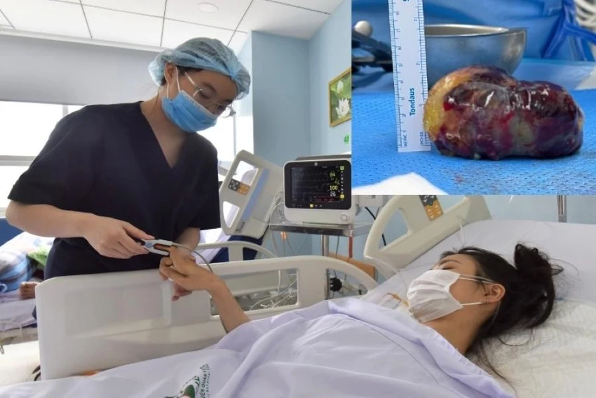 Cô gái mang khối u nhầy nhĩ phải đã qua nguy kịch. Ảnh: BVCC Cô gái mang khối u nhầy nhĩ phải đã qua nguy kịch. Ảnh: BVCC