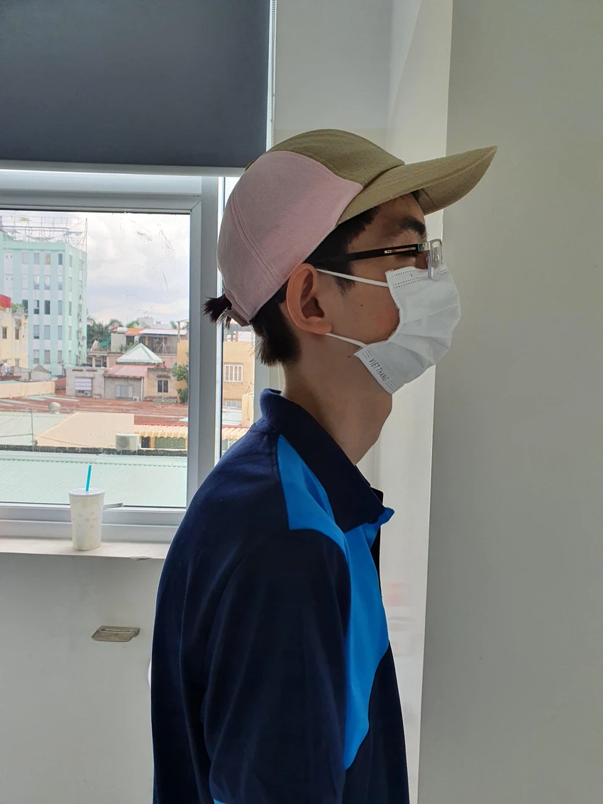 Hình ảnh một người bị mất cân bằng cơ thân trên gây gù lưng. Ảnh: BSCC Hình ảnh một người bị mất cân bằng cơ thân trên gây gù lưng. Ảnh: BSCC
