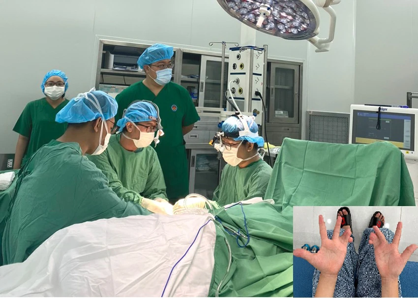 Các bác sĩ đang phẫu thuật tách ngón tay dính liền cho bệnh nhi P (ảnh lớn) và hai bàn “tay cua” của P trước khi phẫu thuật (ảnh nhỏ). Ảnh: BVCC Các bác sĩ đang phẫu thuật tách ngón tay dính liền cho bệnh nhi P (ảnh lớn) và hai bàn “tay cua” của P trước khi phẫu thuật (ảnh nhỏ). Ảnh: BVCC