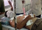Một đại gia bị tạt a-xít khi đang ăn sáng