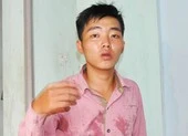 Tạm đình chỉ trưởng công an xã vô cớ bắt, đánh người 