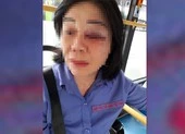Nữ tiếp viên bị đánh bầm mắt vì nhắc khách mở nhạc nhỏ