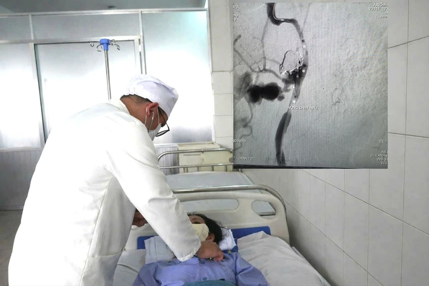 cần thơ,ung thư vòm hầu,can thiệp nội mạch,xuất huyết