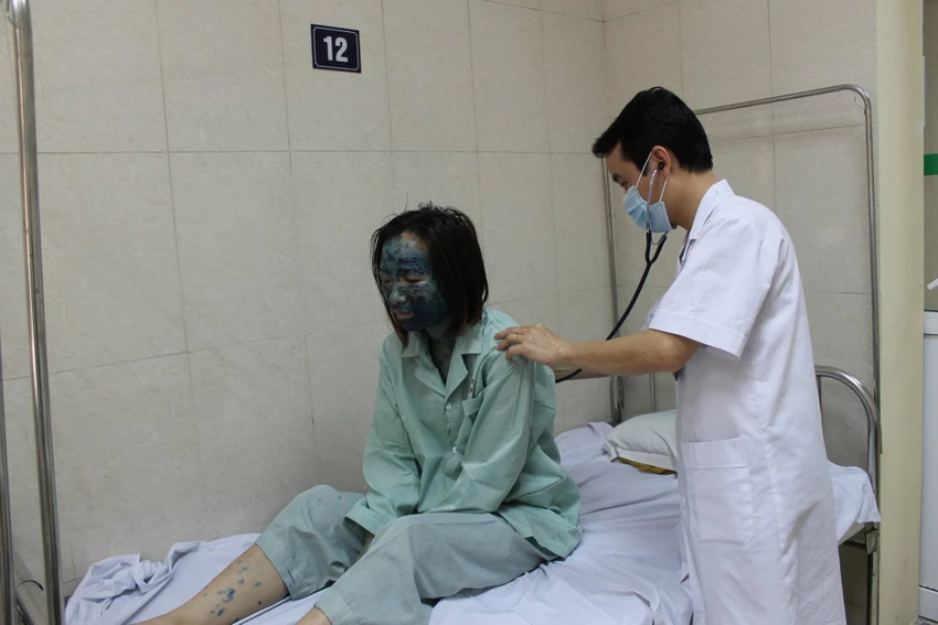 Cảnh báo bùng phát thủy đậu mùa xuân ảnh 1 Cảnh báo bùng phát thủy đậu mùa xuân ảnh 1