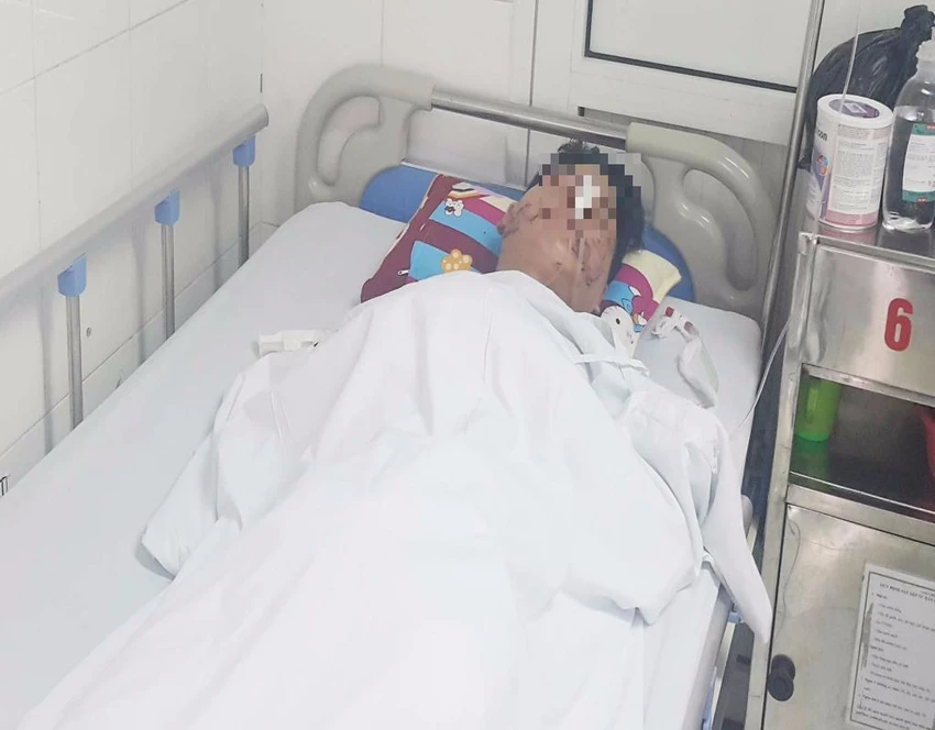 Anh H. đang được điều trị tại BV Việt Đức (Hà Nội)