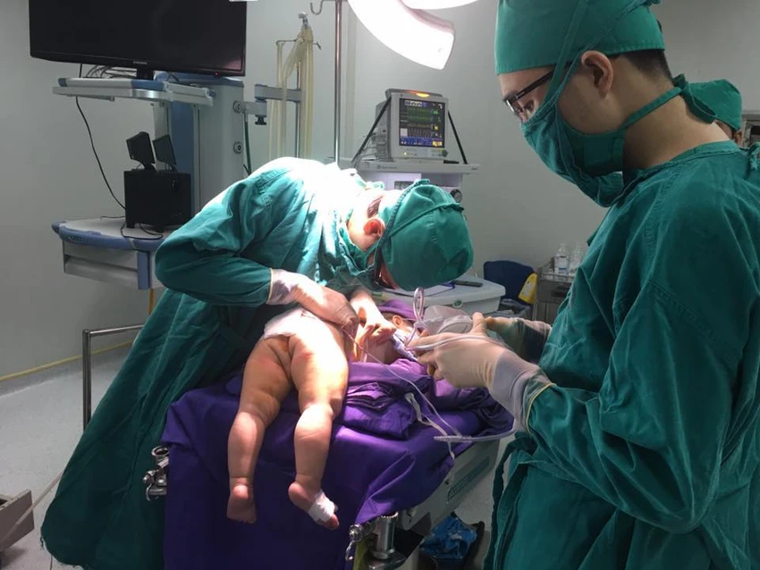 Phẫu thuật cho bệnh nhi không có mông và lỗ hậu môn ảnh 2 Phẫu thuật cho bệnh nhi không có mông và lỗ hậu môn ảnh 2