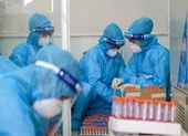 Bộ Y tế lý giải vì sao giá test xét nghiệm COVID-19 lúc cao, lúc thấp