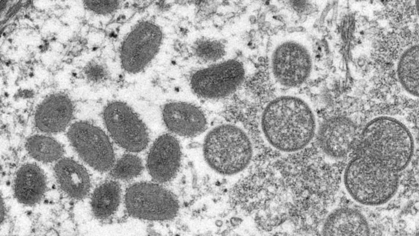 Hình ảnh virus đậu mùa khỉ dưới kính hiển vi. Ảnh: CDC/AFP Hình ảnh virus đậu mùa khỉ dưới kính hiển vi. Ảnh: CDC/AFP