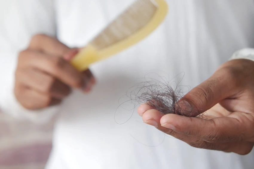 Nếu bạn hay bị rụng tóc nên hạn chế ăn những thực phẩm này