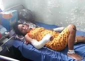 Phẫn nộ: Vợ có thai bị chồng đánh gãy tay chân, vỡ nền sọ
