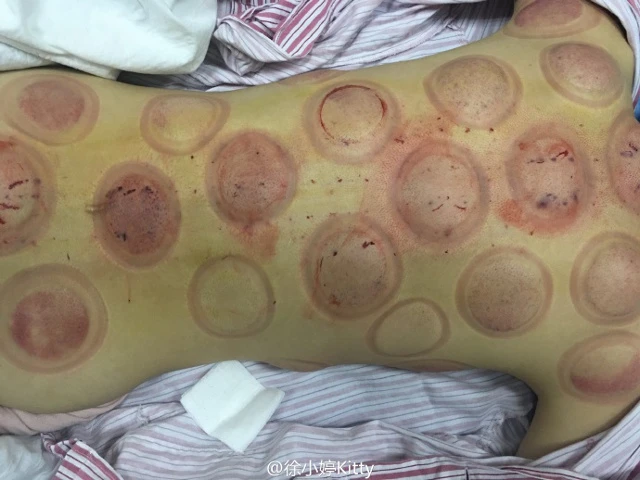 Nữ diễn viên trẻ Trung Quốc Xu Ting.