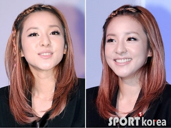Gương mặt của Sandara Park vốn không nhỏ nhắn nhưng được tăng thêm kích cỡ khi nữ ca sĩ lên cân, phần cằm của cô cũng bị gồ ghề.