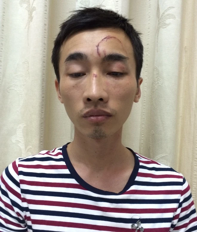 Nghiên trộm tài sản của nhiều phụ nữ mới quen. Nhập mô tả cho ảnh
