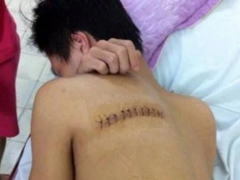 Nạn nhân bị chém rách lưng. Nạn nhân bị chém rách lưng, gục ngã trước cửa nhà.