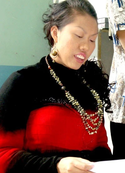 Phi Thanh Vân đắp bột lên mũi để đóng phim: "Nữ hoàng dao kéo" cũng từng khiến khán giả choáng váng, giật mình khi hóa thân thành nhân vật nữ bác sĩ xấu xí trong bộ phimThẩm mỹ viện. Người đẹp từng tiết lộ, cô phải dùng keo, bột thẩm mỹ đắp ngoài mũi thật và đến bác sĩ nha khoa để "đặt hàng" một hàm răng hô cho nhân vật của mình. Chưa hết, Thị Nở thời hiện đại còn sở hữu làn da đầy mụn, kiểu tóc và gu thời trang thảm họa. Việc hy sinh nhan sắc đã giúp "tay ngang" Phi Thanh Vân lột xác trong vai diễn xấu xí. Mỹ nhân Việt kẻ cạo đầu, người ép ngực vì vai diễn