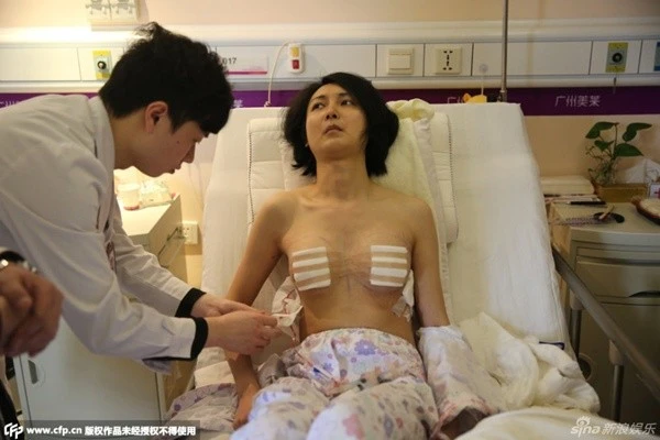 Sau đó, Lưu Đình tiến hành các ca phẫu thuật nâng ngực, chỉnh sửa bộ phận sinh sản. Sau đó, Lưu Đình tiến hành các ca phẫu thuật nâng ngực, bộ phận sinh sản. tả cho ảnh