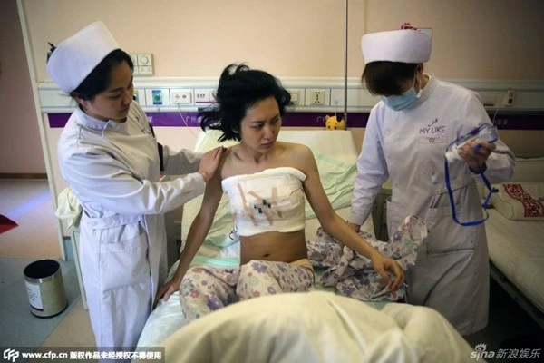 Hình ảnh sau ca mổ. Hình ảnh trên giường phẫu thuật sau ca mổ.