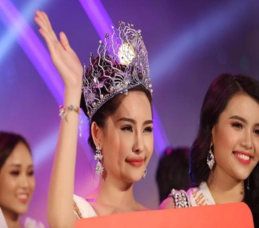 Nhan sắc bị chê là kém tự nhiên của Lê Âu Ngân Anh.