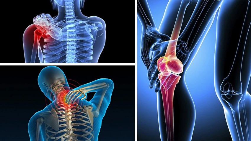 iBONE FiSiO – Nơi gửi trọn niềm tin của bệnh nhân cơ xương khớp.png