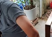 Đang ngồi quán cà phê thì bị bắn 