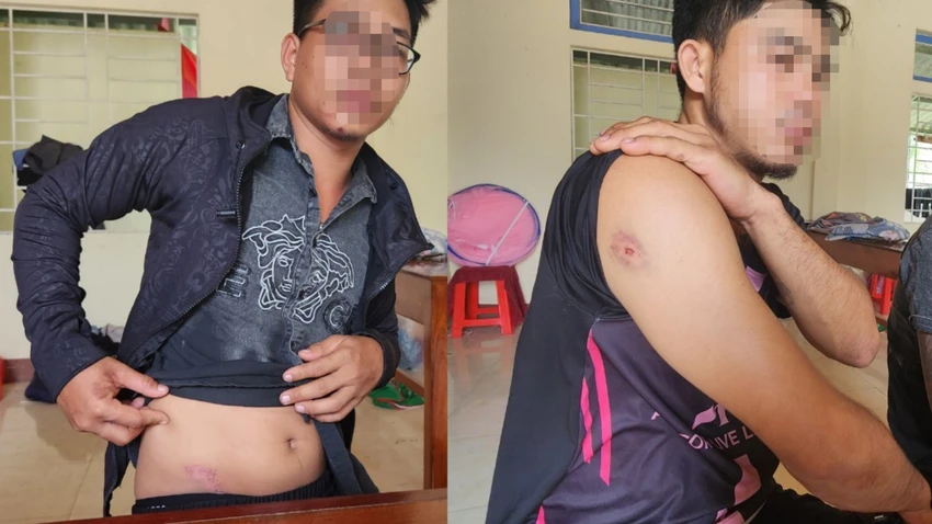 Bị nhóm thanh niên hành hung