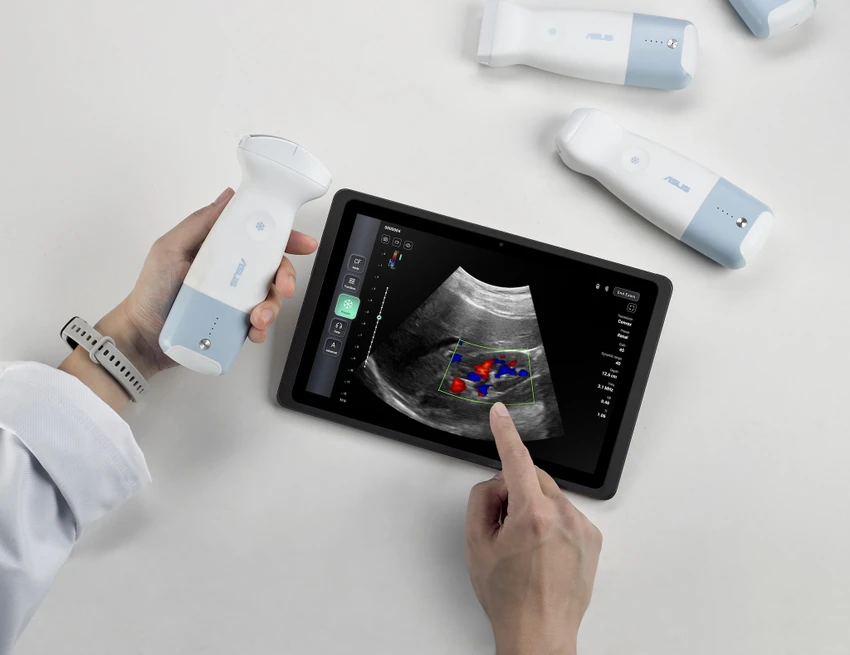Tin công nghệ 2-6: Máy siêu âm cầm tay của ASUS.