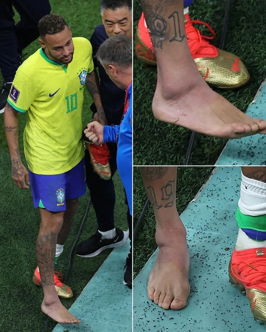 Sau 24-48 giờ tới, chấn thương của Neymar mới cho kết quả chính xác. Ảnh: GETTY
