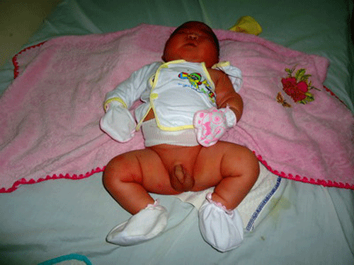 Bé sơ sinh nặng gần 6 kg ảnh 1