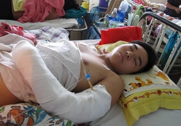Dùng mã tấu chặt lìa tay học sinh ảnh 1 Dùng mã tấu chặt lìa tay học sinh ảnh 1