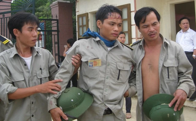 30 người chém trọng thương 3 công nhân cao su ảnh 1