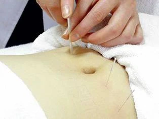 Cấy chỉ chữa tự kỷ: chưa có bằng chứng khoa học ảnh 1