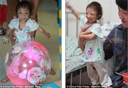 Lạ lùng bé gái không bao giờ lớn ảnh 3 Lạ lùng bé gái không bao giờ lớn ảnh 3