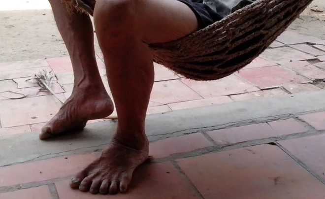 Dòng họ 24 ngón ảnh 2 Dòng họ 24 ngón ảnh 2