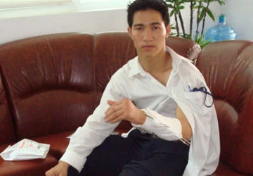 Bị tai nạn lao động có được hưởng BHYT? ảnh 1 Bị tai nạn lao động có được hưởng BHYT? ảnh 1