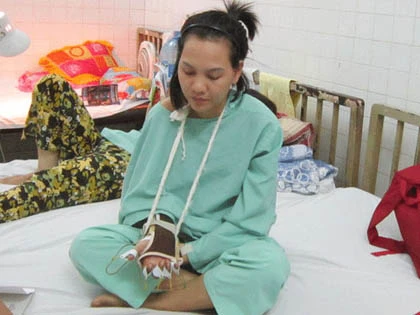 Nạn nhân bị cướp chém lìa tay xuất viện ảnh 1 Nạn nhân bị cướp chém lìa tay xuất viện ảnh 1