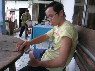 Vụ chặt tay cô gái, cướp xe SH: Bốn tên cướp đều nghiện nặng ảnh 4