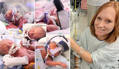 Chỉ mất 5 phút để... sinh liền 5 đứa con ảnh 1 Chỉ mất 5 phút để... sinh liền 5 đứa con ảnh 1